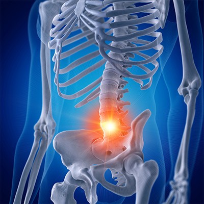 Douleurs dorsales et mal de dos 